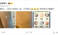 “蟑螂咬人”上热搜 《博物杂志》分析辟谣：三种可能
